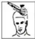Innoliving INN-616 - STEP 4 - TOP OF THE HEAD - 2