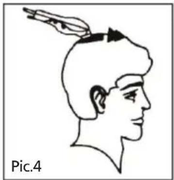 Innoliving INN-616 - STEP 4 - TOP OF THE HEAD - 1
