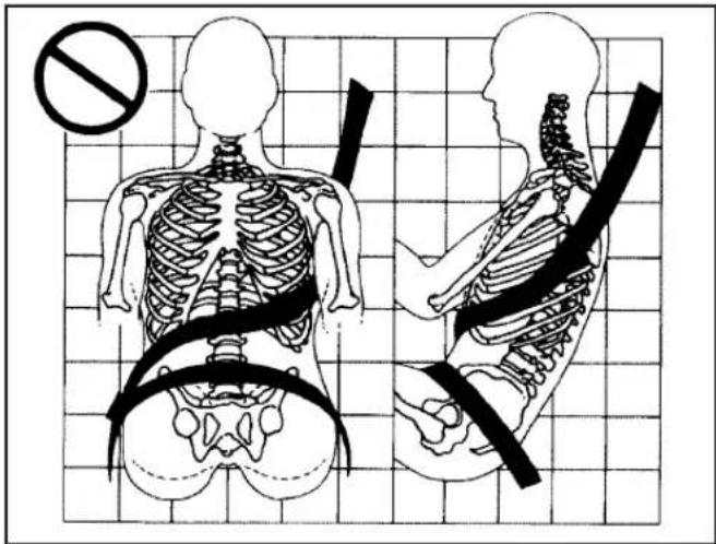 Medical illustration showing front and side views of human skeletal anatomy with a no-smoking symbol above the spine.