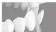 PANASONIC EW1613 - Orthodontic nozzle - 1