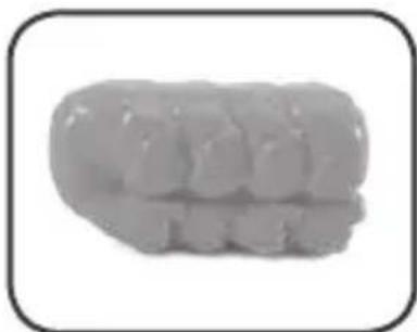 Close-up of a dental model showing teeth and jawbone structure (no text or symbols)