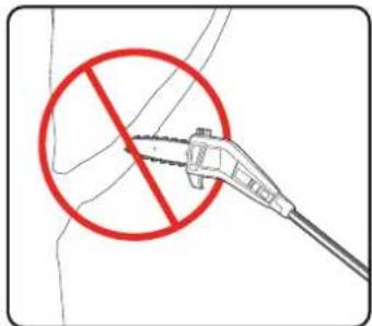 Safety warning symbol with red prohibition circle and medical device illustration