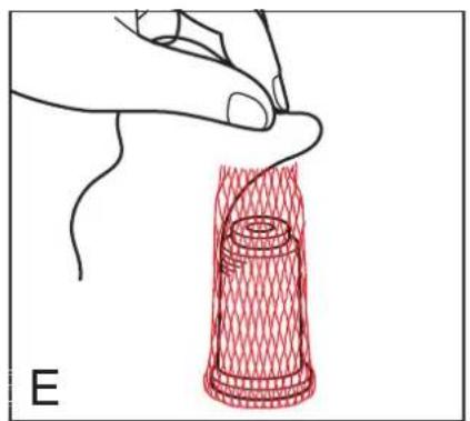 Hand holding a red wire mesh device with a pointed tip, labeled 'E' (no text or symbols on the diagram itself)