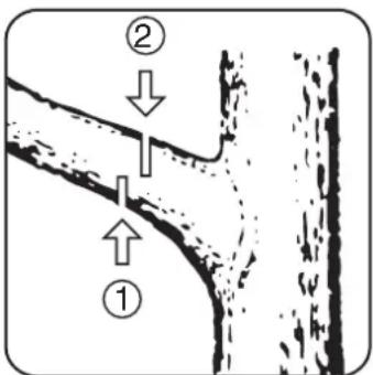 Diagram showing two labeled arrows pointing to a cross-sectional structure, with numbered annotations (① and ②) indicating directional flow or process.