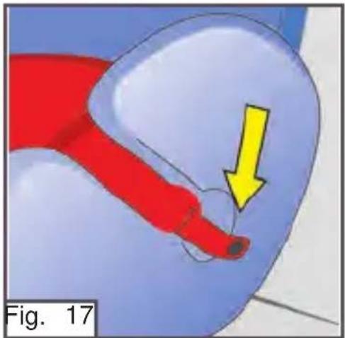 Medical illustration showing a red anatomical structure with a yellow arrow pointing to a specific region, labeled 'Fig. 17' (no text or symbols on the diagram itself)