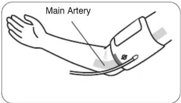 Main Artery