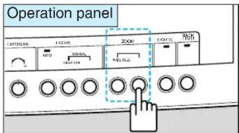 Operation panel EXPOSURE FOCUS ZOOM LIGHTS FET AUTO WARNING WHOLE FET OK FET
