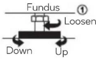Fundus ① Loosen Down Up