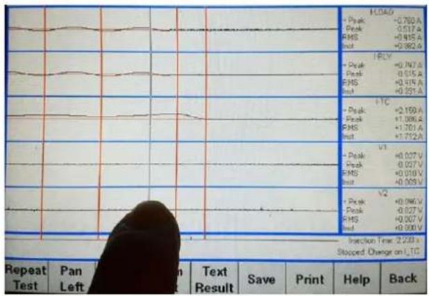 HOLD + Peak -0.780 A Peak -0.517 A RMS +0.495 A Inst +0.382 A + RLY + Peak -0.167 A Peak -0.015 A RMS +0.119 A Inst +0.051 A + TC + Peak -0.159 A Peak -1.096 A RMS +1.701 A Inst +1.712 A V1 + Peak -0.027 V Peak -0.027 V RMS +0.018 V Inst +0.009 V V2 + Peak -0.096 V Peak -0.027 V RMS +0.007 V Inst +0.000 V Infection Time: 2:23:33 Stopped Change on LTCE Repeat Test Pan Left Text Result Save Print Help Back