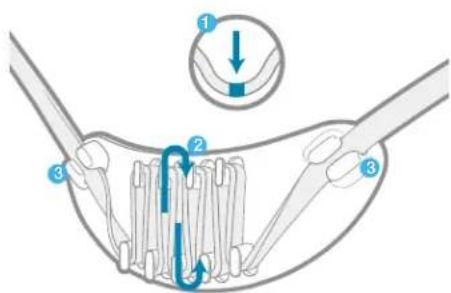 Diagram illustrating a biological or mechanical process with numbered components and directional arrows, likely depicting a procedure or assembly.