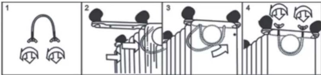 Diagram illustrating four stages of a medical procedure involving earplugs, tubing, and surgical tools with labeled steps 1 to 4.