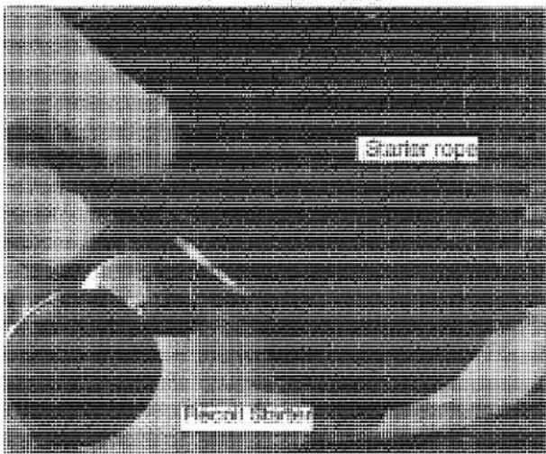 Starter rope Pascal Starbur