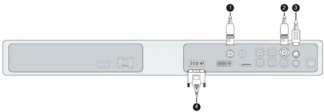 Diagram of a remote control panel with labeled ports and connectors, showing ports 1, 2, and 3 connected to a device interface.