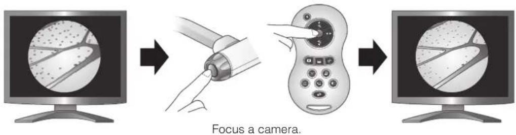 Focus a camera.