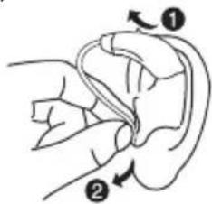 Diagram showing ear anatomy with labeled parts and directional arrows indicating movement or force