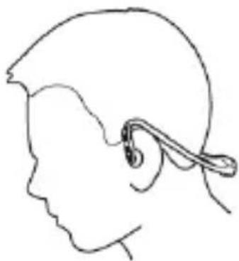 Zipy GO EarAir - Appareillage multiple - 1