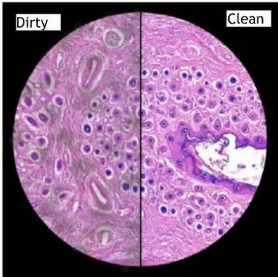 Dirty Clean