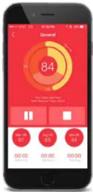General 84 4% change mean time Total Vennous Time (0:00) Max HR 87 Avg HR 85 Min HR 84 00.02 00.00 00.00 Time