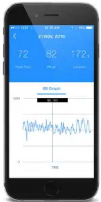21 Nov; 2016 72 Heart Rate 82 VPS rate 172. Ovadon IDI Graph 1500 88.790 TIME