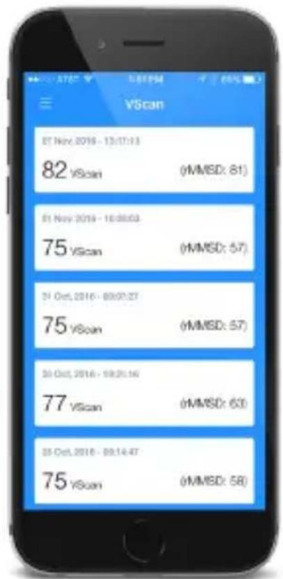 VScan 07 Nov, 2016 - 13:17:13 82 VScan (MMSD: 81) 01 Nov, 2016 - 16:30:03 75 VScan (MMSD: 57) 31 Oct, 2016 - 09:07:27 75 VScan (MMSD: 57) 30 Oct, 2016 - 19:25:16 77 VScan (MMSD: 63) 35 Oct, 2016 - 09:14:47 75 VScan (MMSD: 58)