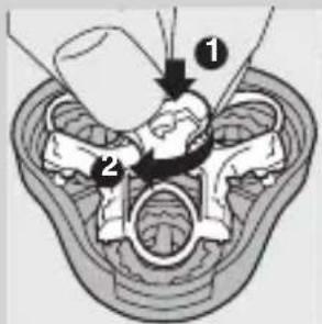 Medical diagram showing anatomical structures with numbered labels and arrows indicating specific regions