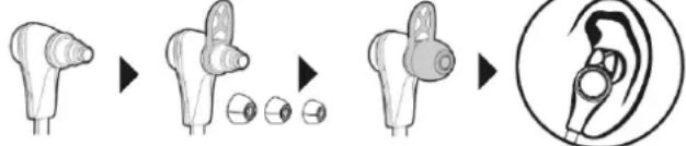 Diagram illustrating the progressive stages of ear ear replacement, showing before, mid, and post states with corresponding illustrations.