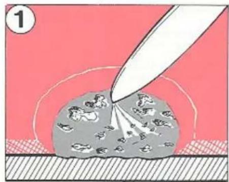 VOLVO 760 (1987) - Kleine steenslagplekken en krassen - 1
