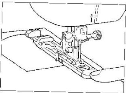 BROTHER Super Ace II M955 - ① Plaatje - 2