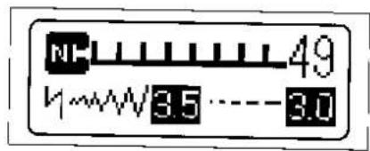 BROTHER Super Ace II M955 - DEKORATIEVESTEKEN (ERFSTUKSTEEK) - 1