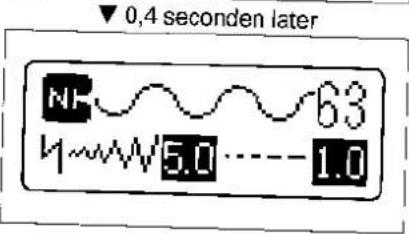 ▼ 0,4 seconden later NF 63 4~5.0 1.0