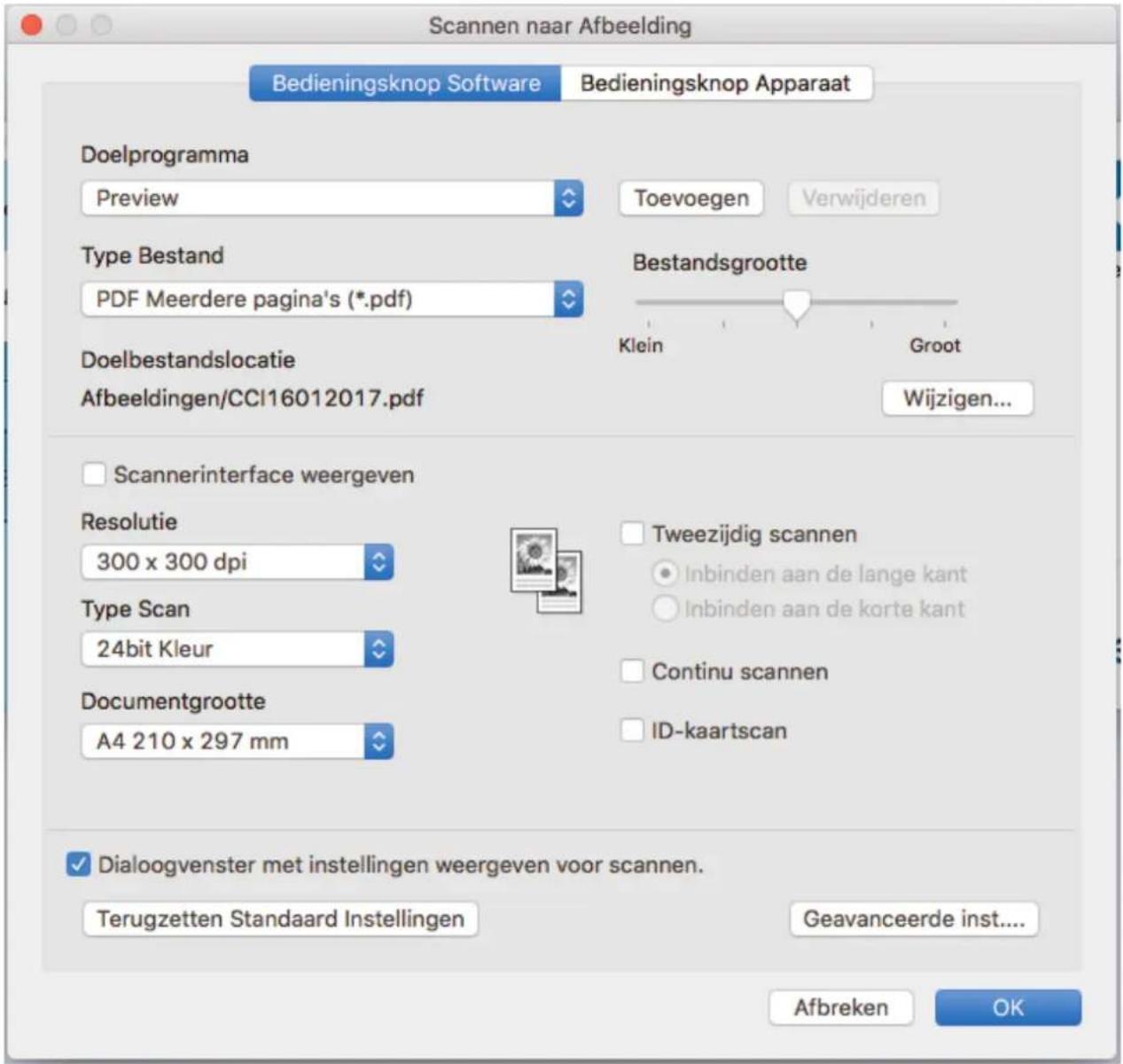 Scannen naar Afbeelding Bedieningsknop Software Bedieningsknop Apparaat Doelprogramma Preview Toevoegen Verwijderen Type Bestand PDF Meerdere pagina's (*.pdf) Bestandsgrootte Klein Groot Wijzigen... Doelbestandslocatie Afbeeldingen/CCI16012017.pdf Scannerinterface weergeven Resolutie Tweezijdig scannen 300 x 300 dpi Inbinden aan de lange kant Type Scan Inbinden aan de korte kant 24bit Kleur Continu scannen Documentgrootte ID-kaartscan A4 210 x 297 mm Dialogoogvenster met instellingen weergeven voor scannen. Terugzetten Standaard Instellingen Geavanceerde inst.... Afbreken OK