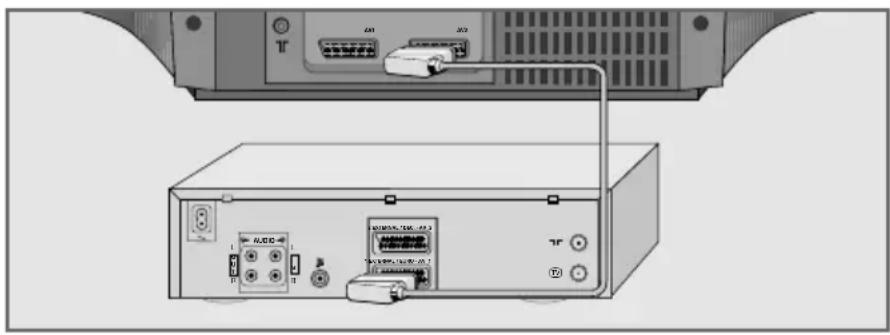 GRUNDIG ST 70-2410 - Videorecorder, dvd-speler of SET-TOP-Box aansluiten - 1