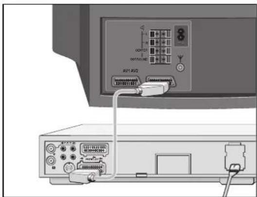 GRUNDIG ST 70 810 DPL - Videorecorder of SET-TOP-box op aansluiting »AV 2« aansluiten - 1