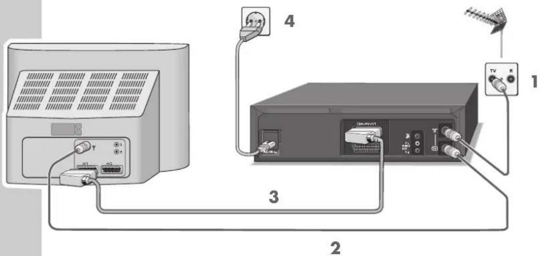 GRUNDIG Vivance GV 3042 - IN EEN OOGOPSLAG - 2
