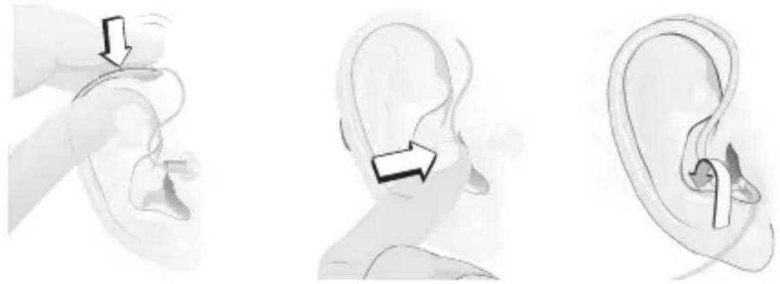 Sonic Charm Nano RITE - Inserting Your Hearing Instrument - 1