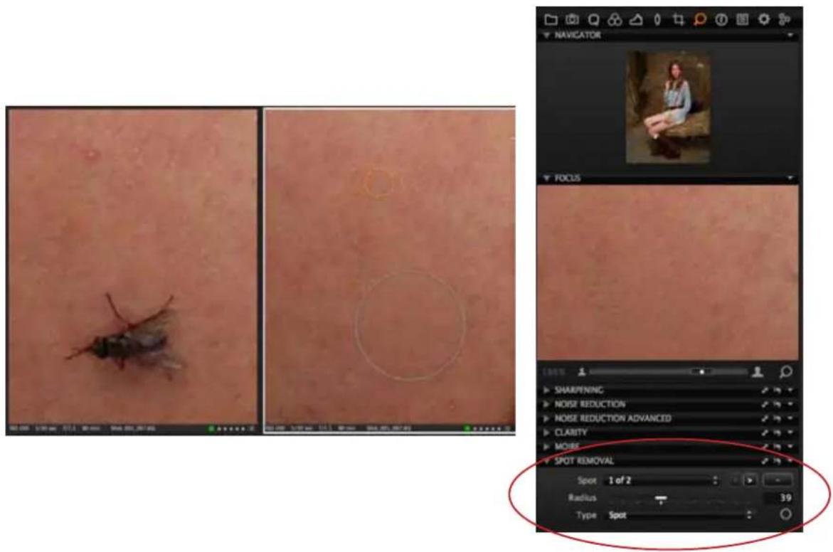 Medical image processing workflow showing skin treatment, eye examination, and spot removal steps with a 3D preview of a seated individual.