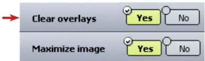 Clear overlays Yes No Maximize image Yes No