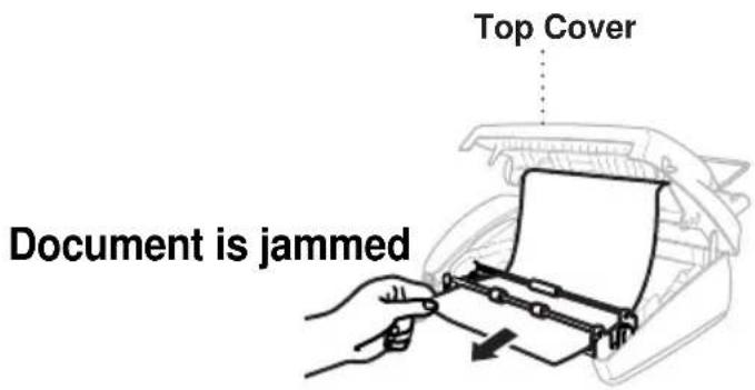 Top Cover Document is jammed
