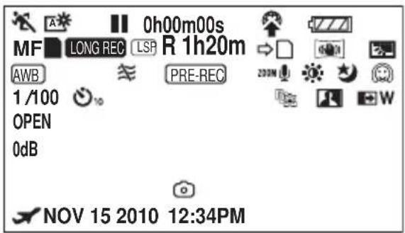 MF LONG REC LSP R 1h20m AWB PRE-REC 1/100 OPEN 0dB NOV 15 2010 12:34PM