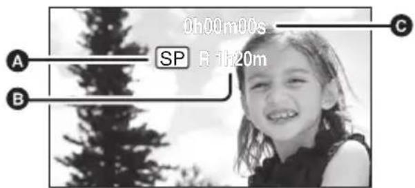 0h00m00s SP R 1h20m A B C