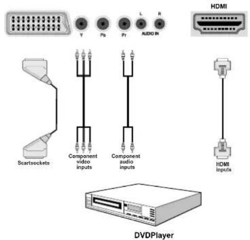 HDMI Y Pb Pr L R Scartisockets Component video inputs Component audio inputs HDMI Inputs DVDPlayer