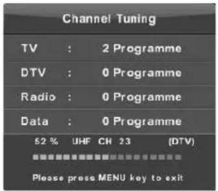 Vivax TV-40LE78T2S2 - Automatsko postavljanje - 5