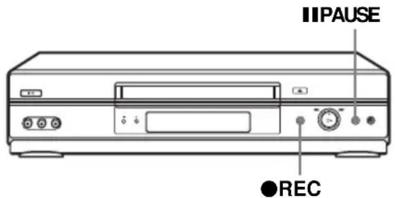 IIPAUSE ●REC