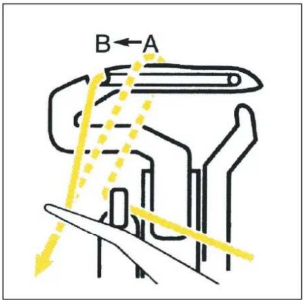 B ← A