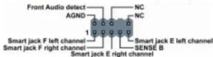 ECS PF21 Extreme - Battery - 14