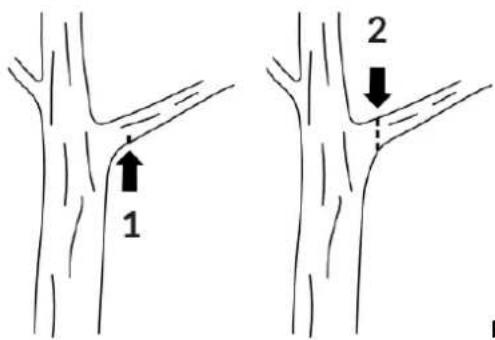 1 2