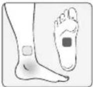 Medel Myo Tens LT3062E - KROK 3 - 17