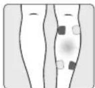 Medel Myo Tens LT3062E - KROK 3 - 15
