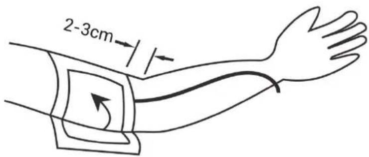 2-3cm