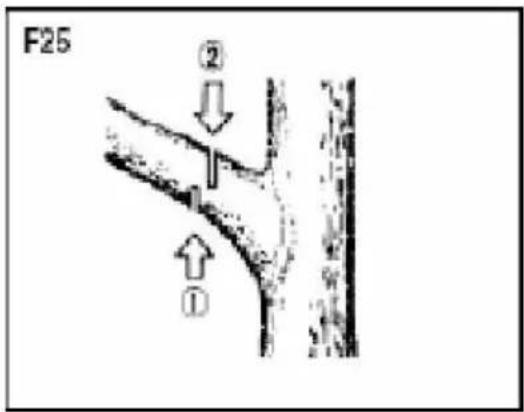F25 ② ①